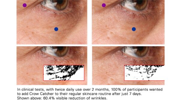 A series of images showing the different stages of a person's eye.