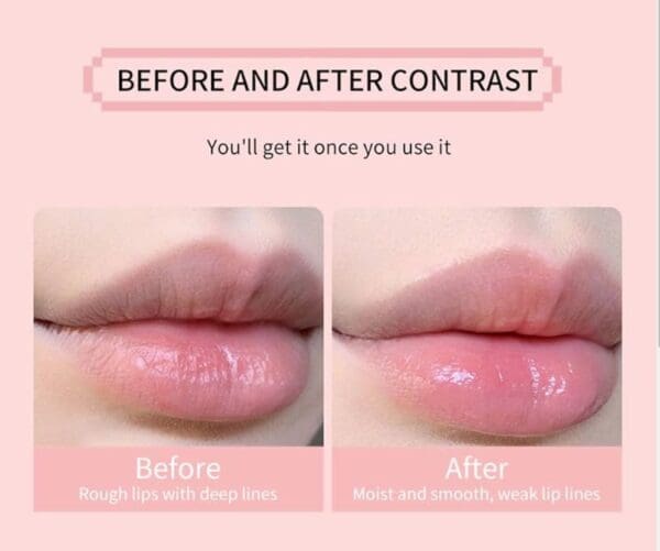 Lip before and after treatment.